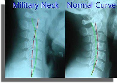military neck       corrected   fix