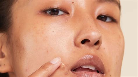 The 16 best acne spot treatments of 2023 for pimple free skin | CNN ...