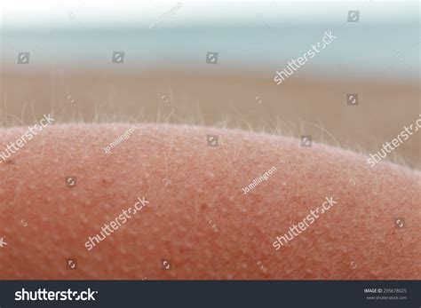 434 Chicken skin arm Images, Stock Photos & Vectors | Shutterstock