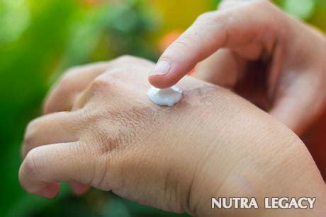 Top 5 Natural Methods of Burn Scar Treatment