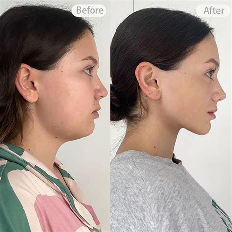 face workouts