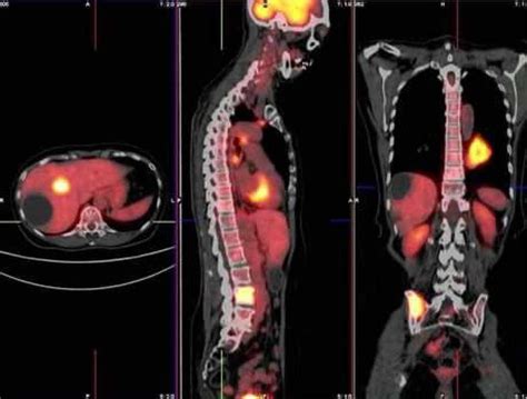 Nuclear Medicine Radiology | DocPanel | docpanel.com