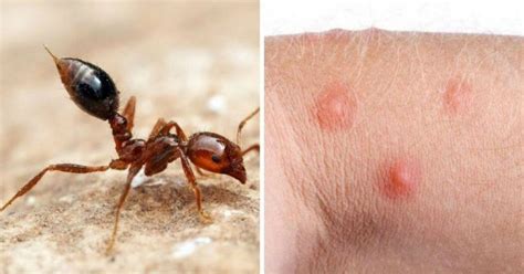 Alergia A Picadas De Formigas - Como reconhecer todas as 12 picadas de insetos mais comuns - Minilua