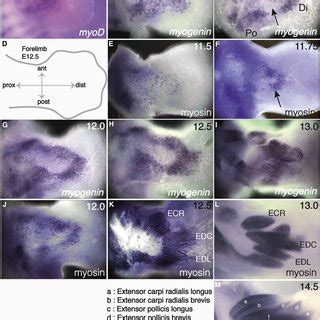 individual muscle bundles form  progressive series  steps
