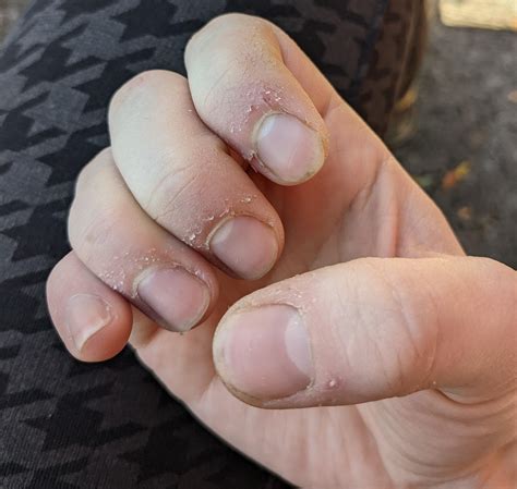 Strange lines on my neck and shoulder/collarbone areas,does anybody