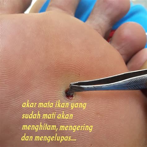 obat penyakit mata ikan dalchaebi