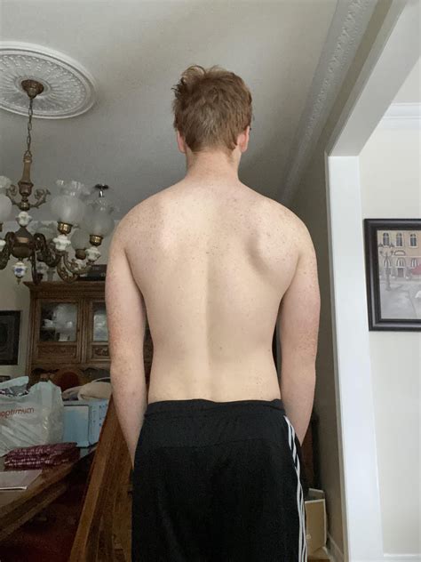 [Posture Check] Mild Scoliosis : r/scoliosis