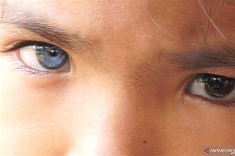 bermata tidak pandai melihat