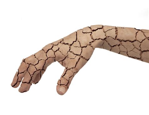 Learning update: Cracking patients' skin conditions