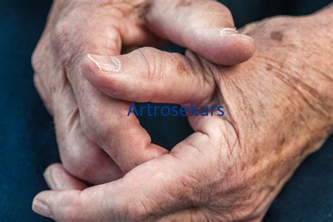 artrose   laeringskurs pa kompetansebroen