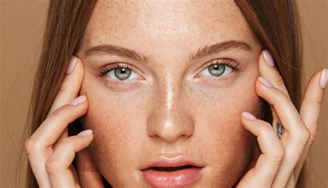 5 Best Home Remedies To Try for Milia - lifeberrys.com