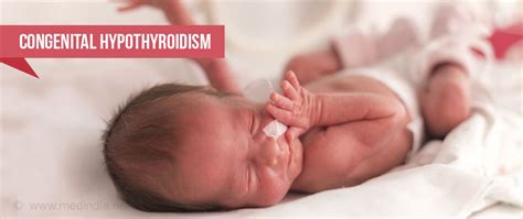 Congenital Hypothyroidism | Cretinism - Causes, Symptoms, Diagnosis ...