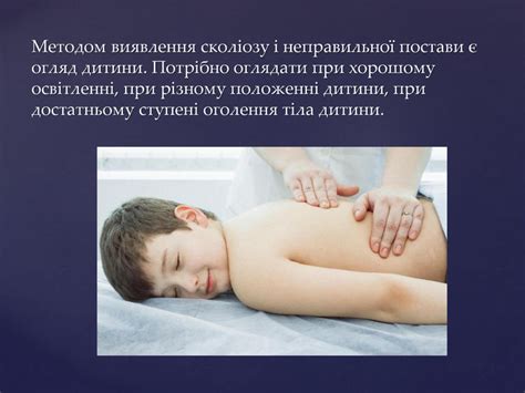 Презентація "Сколіоз"