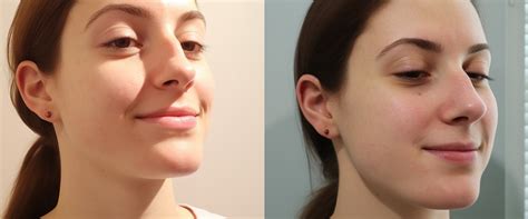 how to get a cheekbone
