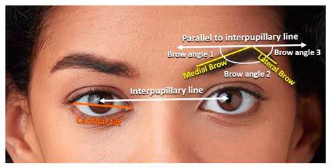 positive canthal tilt 9