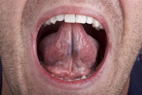 What Is Skin Called Under Tongue at JENENGE blog
