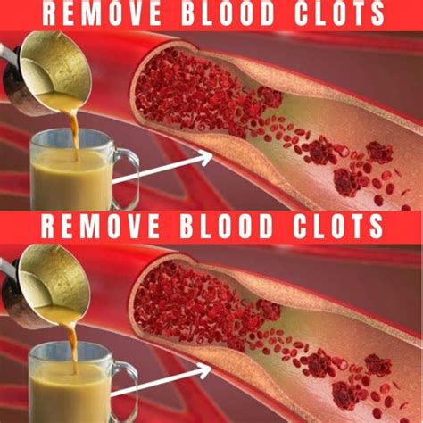 Drinking One Cup Daily Will Prevent Blood Clots.