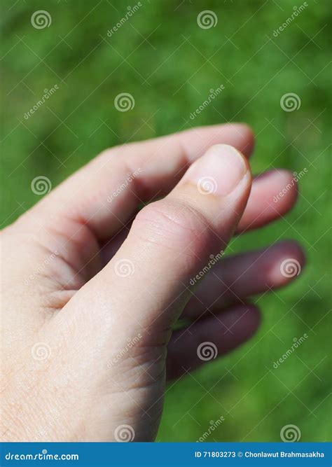 Index Finger Joint Pain At Night at Michael Dittmer blog