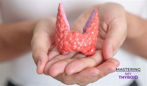 hashimotos thyroiditis mastering  thyroid