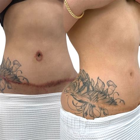 Medical Tattooing Courses