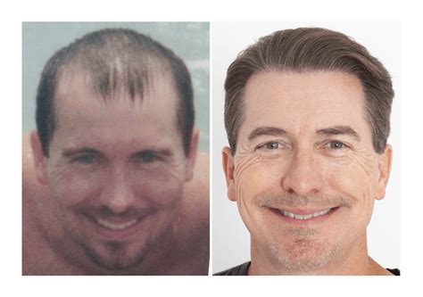 Jw Woodward: Before & After Results That Will Shock You Image 20