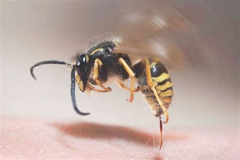 Home Remedies to Treat Wasp Stings
