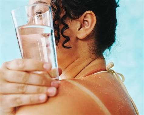 treat  sunburn tips  pain peeling     york