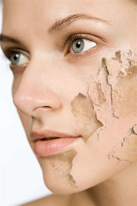Dry skin solution – Artofit