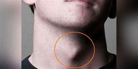 Men's throat Why did the bone get more outdoors? Does it happen? — Steemit