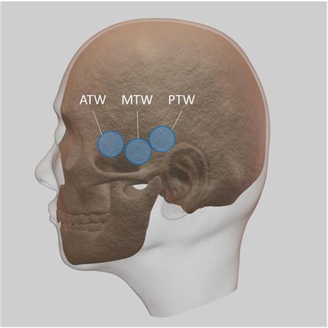 success rate  transcranial doppler scanning  cerebral arteries
