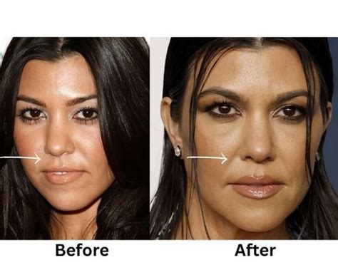 9 Plastic Surgeries Explain Kourtney Kardashian's Transformation | Fabbon