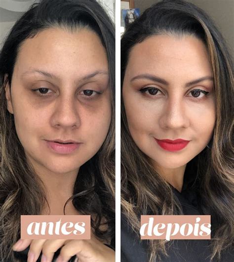 Olheiras Antes E Depois - Olheiras Sob Os Olhos Antes E Depois Tiana Burmann | Antes E Depois