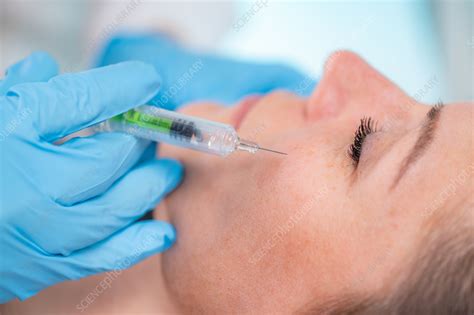 Cheek filler injection - Stock Image - F042/6084 - Science Photo Library