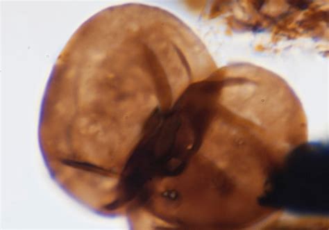 Discovered: Fossilized Spores Suggestive of Early Land Plants | The ...