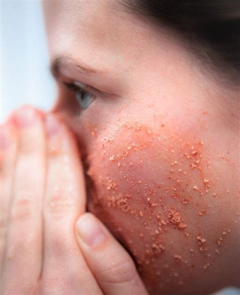 jadwal eksfoliasi berdasarkan jenis kulit jangan sampai salah