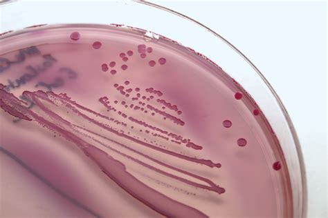 E. coli | Pathogenic, Infection, Contamination | Britannica