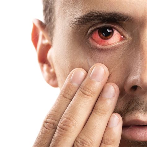 how to heal broken blood vessel in eye fast 6