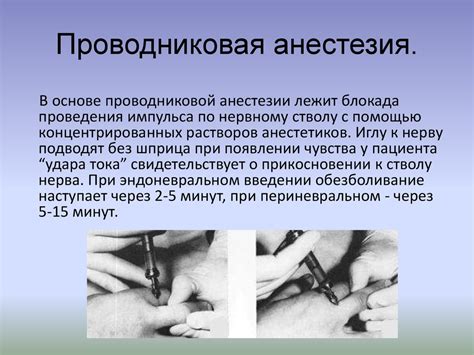 Местная анестезия - online presentation