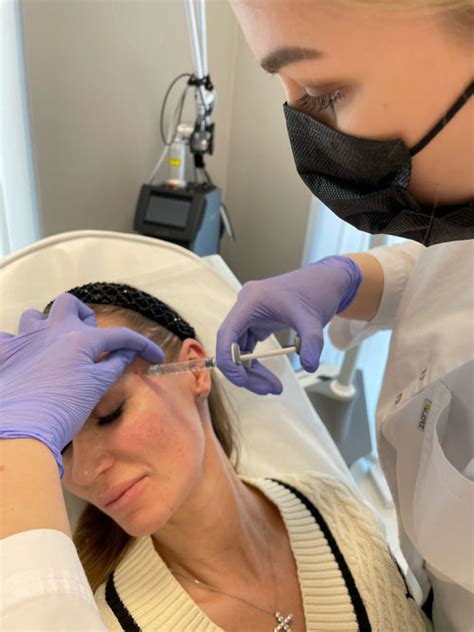 how long for lip filler swelling to go down