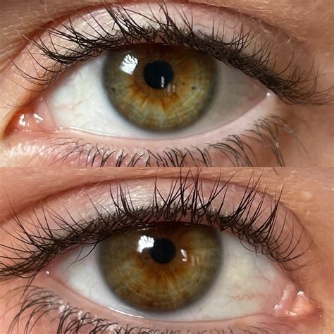 hazel  central heterochromia reyes