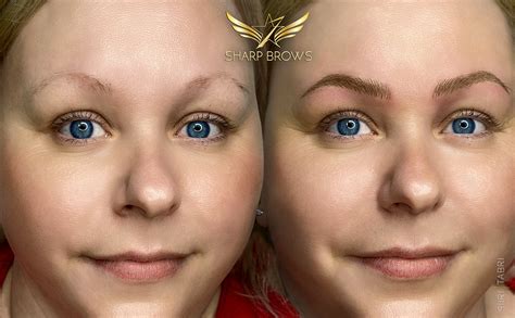 Faydwynn Morningstar's Transformation: A Before & After Story Of Hope