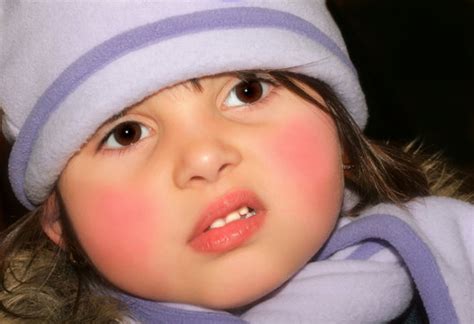 rosy cheeks images browse  stock  vectors  video