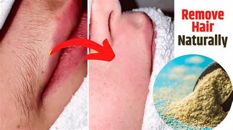 unbelievable!| how to get rid of facial hairs, remove ingrown hairs ...