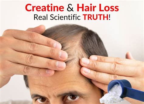Debunking The Myth: Does Creatine Cause Hair Loss | UK Hair Transplants ...