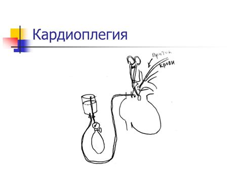 Обеспечение операций на открытом сердце. Гипотермическая защита и ...
