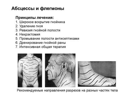 Гнойные заболевания наружной локализации - online presentation