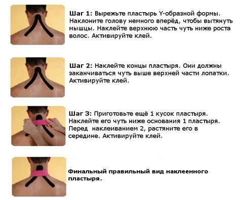 Тейпирование шеи — правила применения и отзывы о результатах