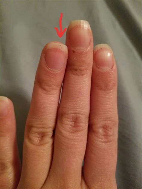 Stabbing pain in right side of neck. Why? : r/ChronicPain