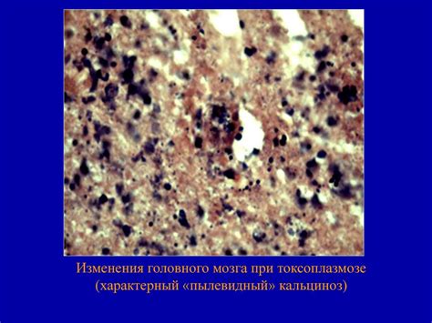 Патология перинатального периода - online presentation