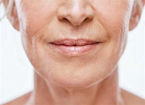 Ozempic Face: Causes and Prevention Tips - Blufashion